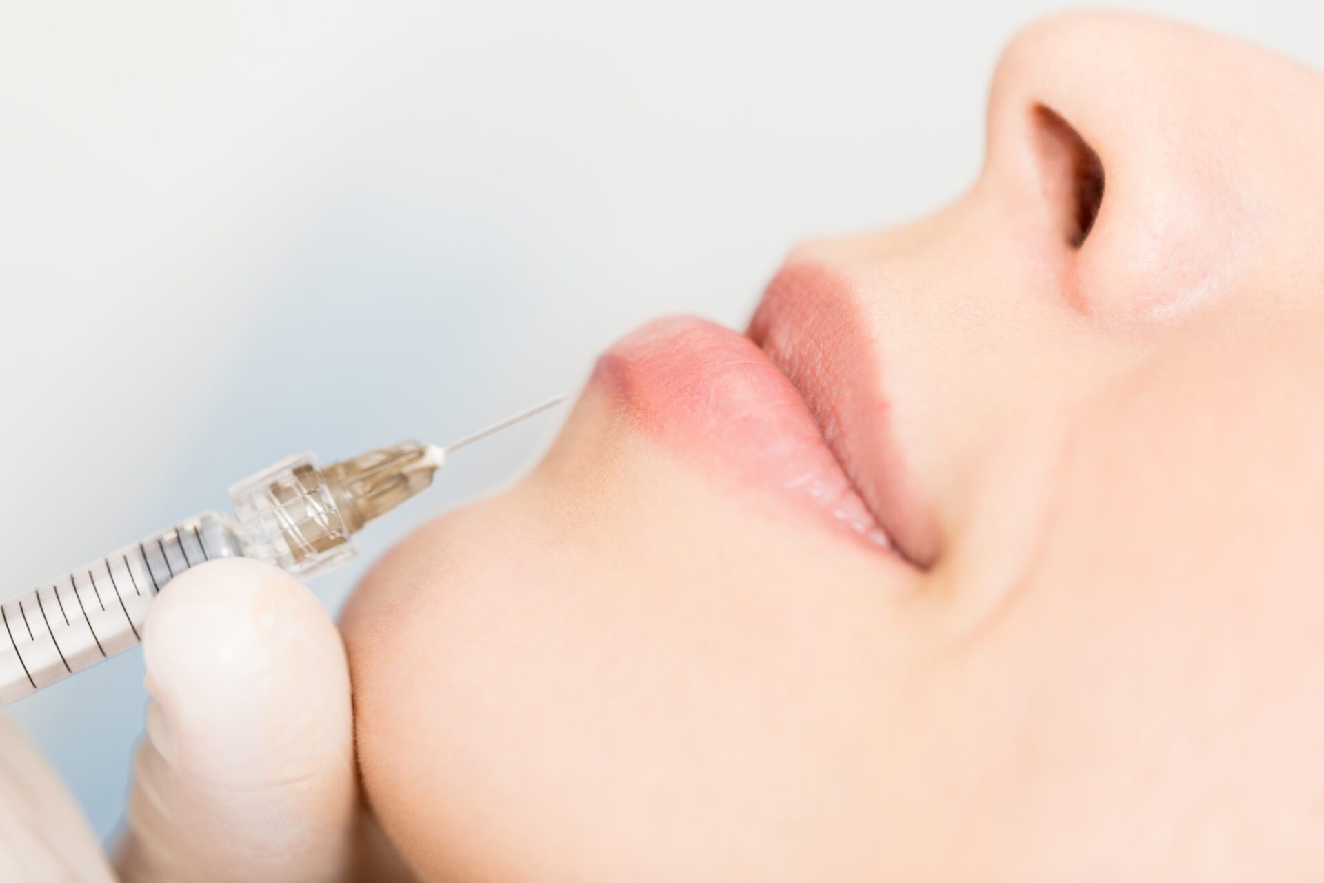 Woman getting lip filler with hyaluronic acid lip filler